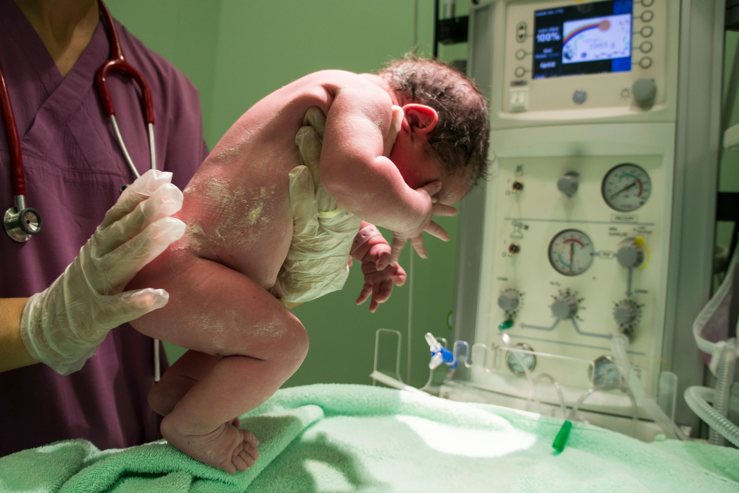 NICU